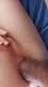 Anal